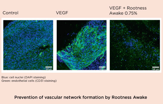 Rootness Awake prevents vascular network formation