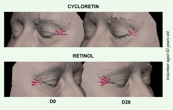 Clariant-image-wrinkles-vs-retinol-2024