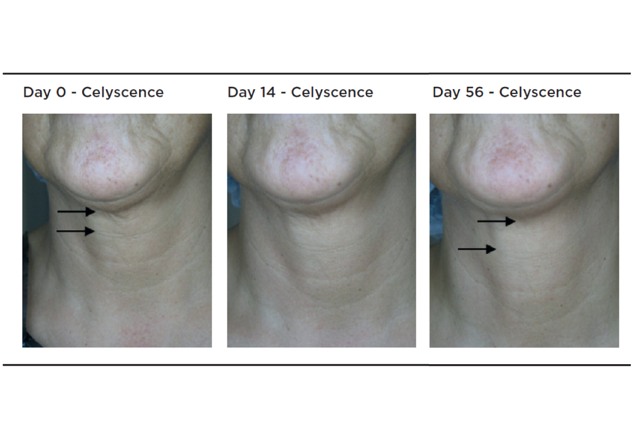 Clariant_Image_clinical results_2021_EN-01